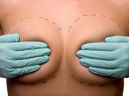 50 Greatest Plastic Surgery Shockers